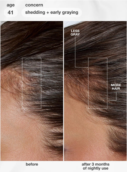 Before-and-after comparison of a person's hair at the crownline, showing early gray hair shedding on the left and fuller, darker hair on the right, with text labels 'before', 'after 3 months of nightly use', 'age 41', and 'shedding + early graying'. The model is using a K18 hair serum