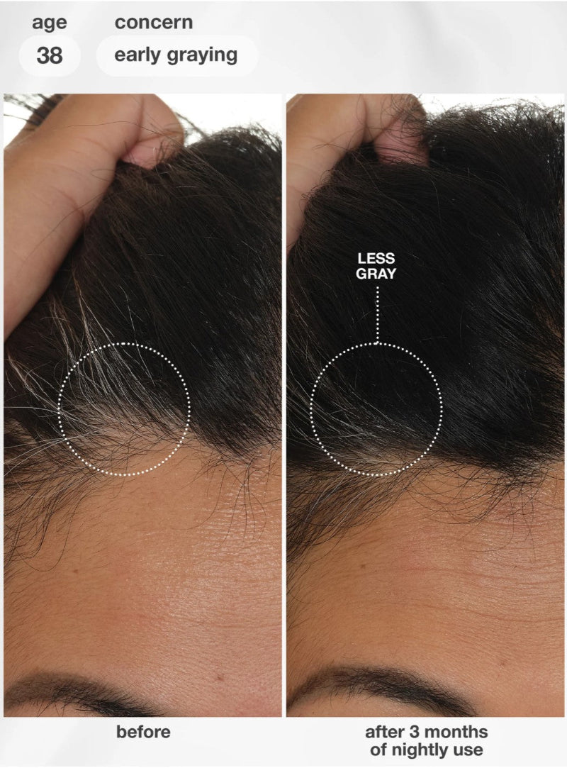 Before-and-after comparison of a person's hair at the hairline, showing premature gray hair in the left panel labeled 'before' and fuller, darker hair in the right panel labeled 'after 3 months of nightly use'. Text at the top reads 'age 38 concern early graying'. The model is using a K18 hair serum