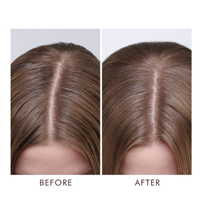 Before and after comparison of hair treatment on a person's head. The comparison shows the model attained a visible results after using Moroccanoil dry scapl treatment 