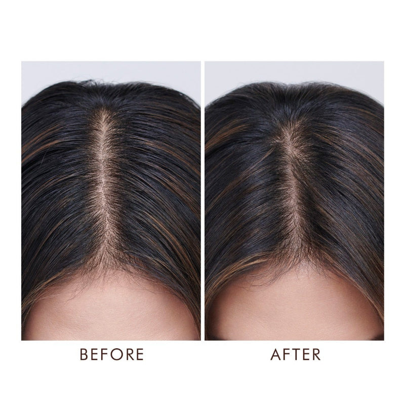 Before and after comparison of hair treatment on a person's head after using Moroccanoil oily scalp treatment